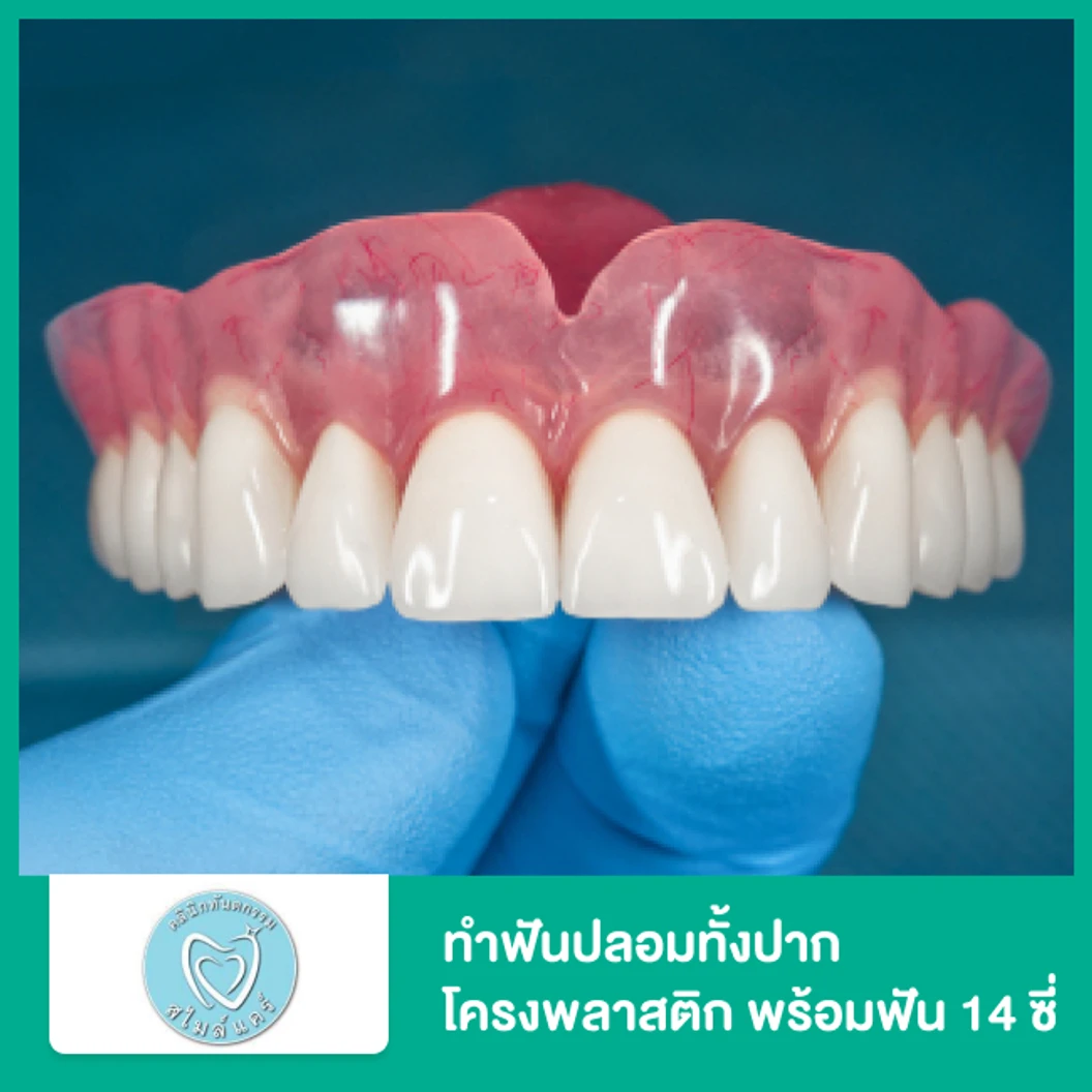ทำฟันปลอมทั้งปาก โครงพลาสติก แผงบนหรือล่าง พร้อมฟัน 14 ซี่