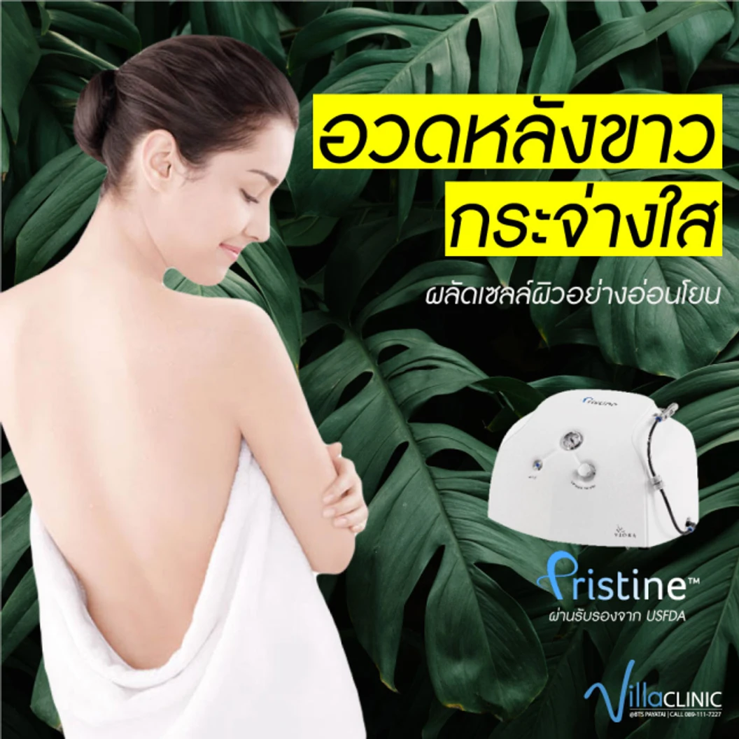 Extra Shiny Back ทำทรีตเมนต์กระชับผิว ด้วยคลื่น Ultrasonic บริเวณแผ่นหลัง 1 ครั้ง
