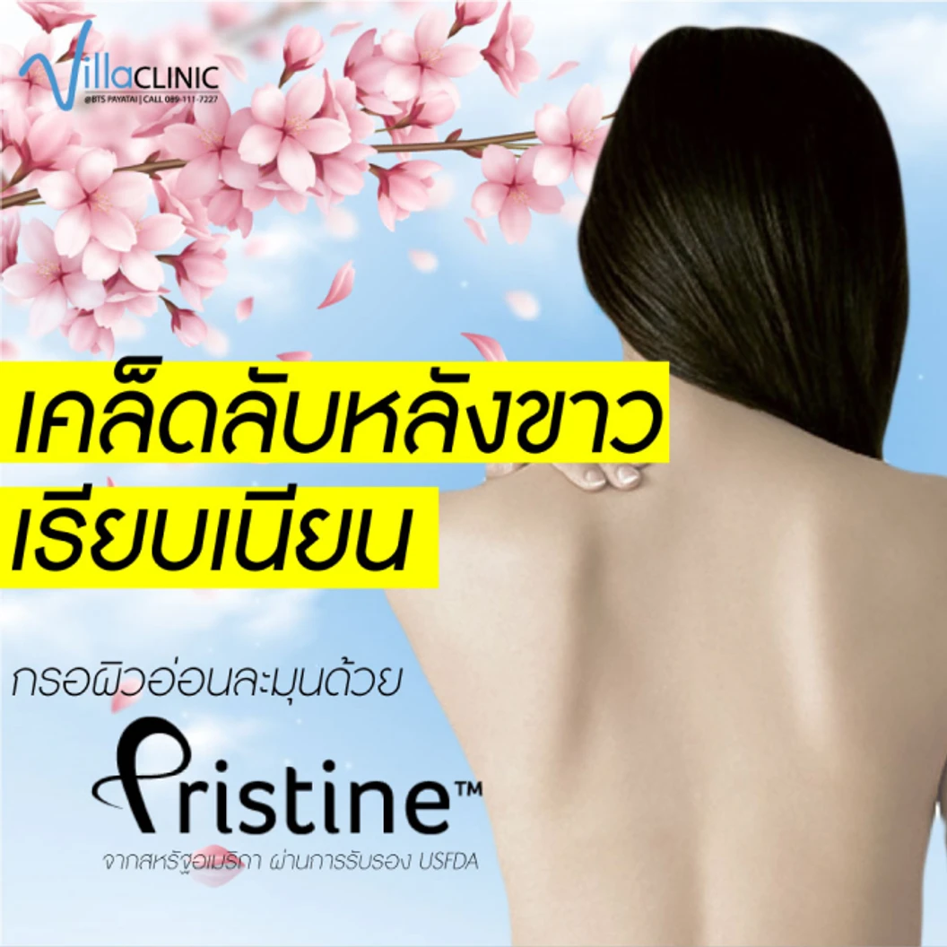 Extra Shiny Back ทำทรีตเมนต์กระชับผิว ด้วยคลื่น Ultrasonic บริเวณแผ่นหลัง 1 ครั้ง