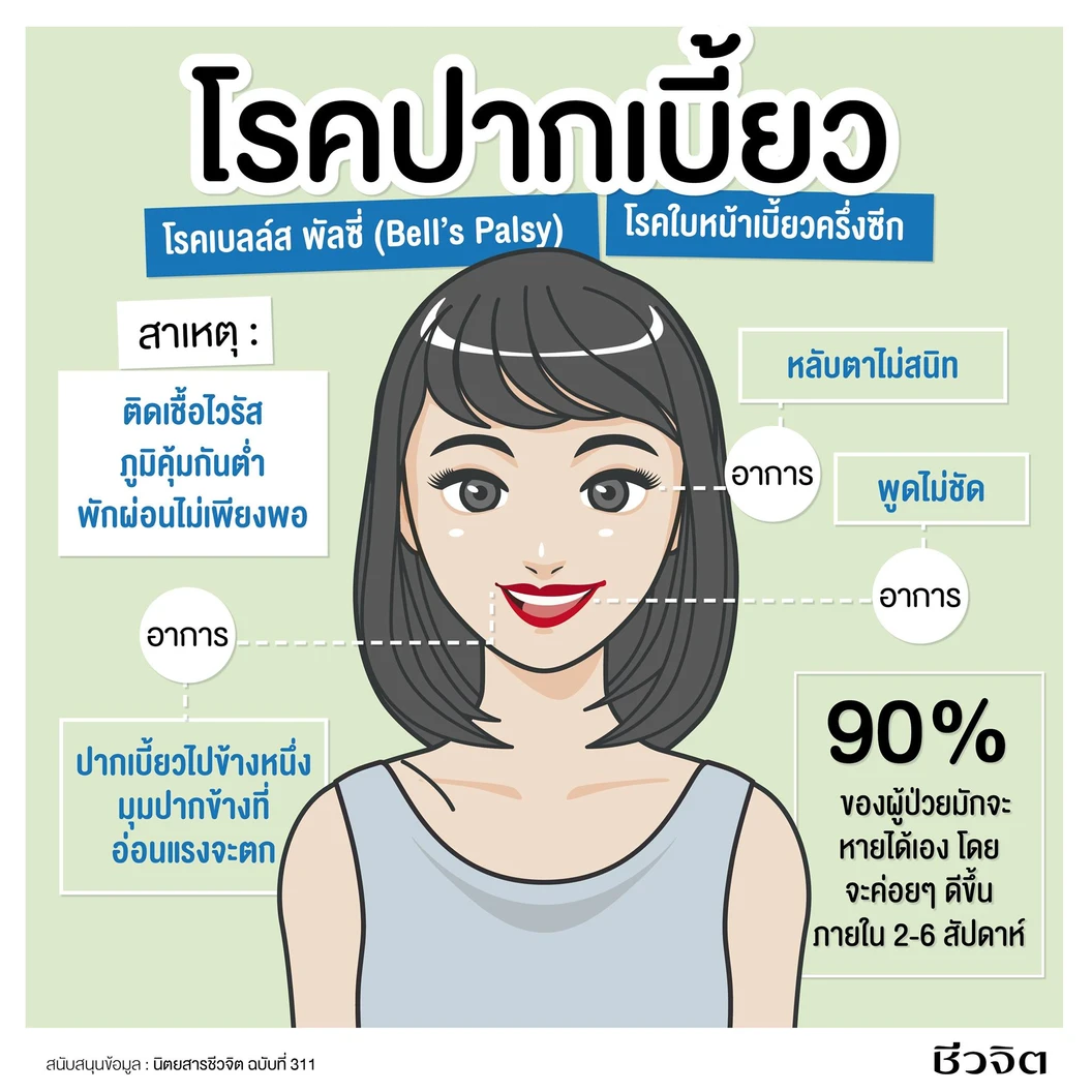 กายภาพบำบัดรักษาโรคใบหน้าเบี้ยวครึ่งซีก (Bell's Palsy) 1 ครั้ง