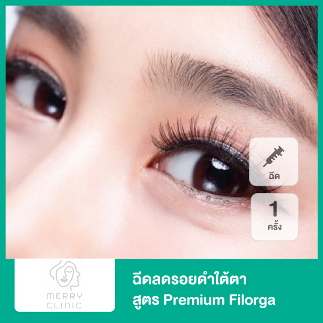 ฉีดลดรอยดำใต้ตา สูตร Premium Filorga 1 ครั้ง ที่ Merry Clinic