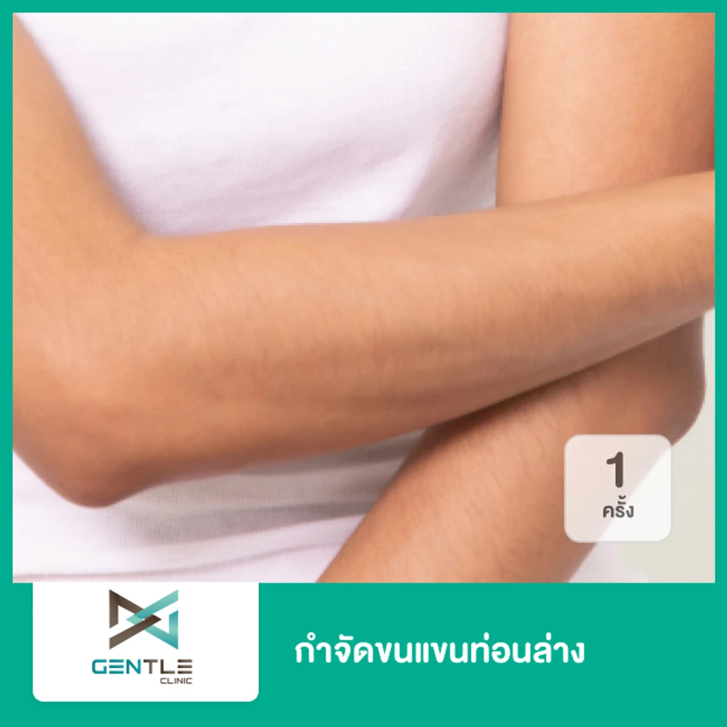 กำจัดขนแขนท่อนล่าง ด้วยเลเซอร์ Trio Diode 1 ครั้ง