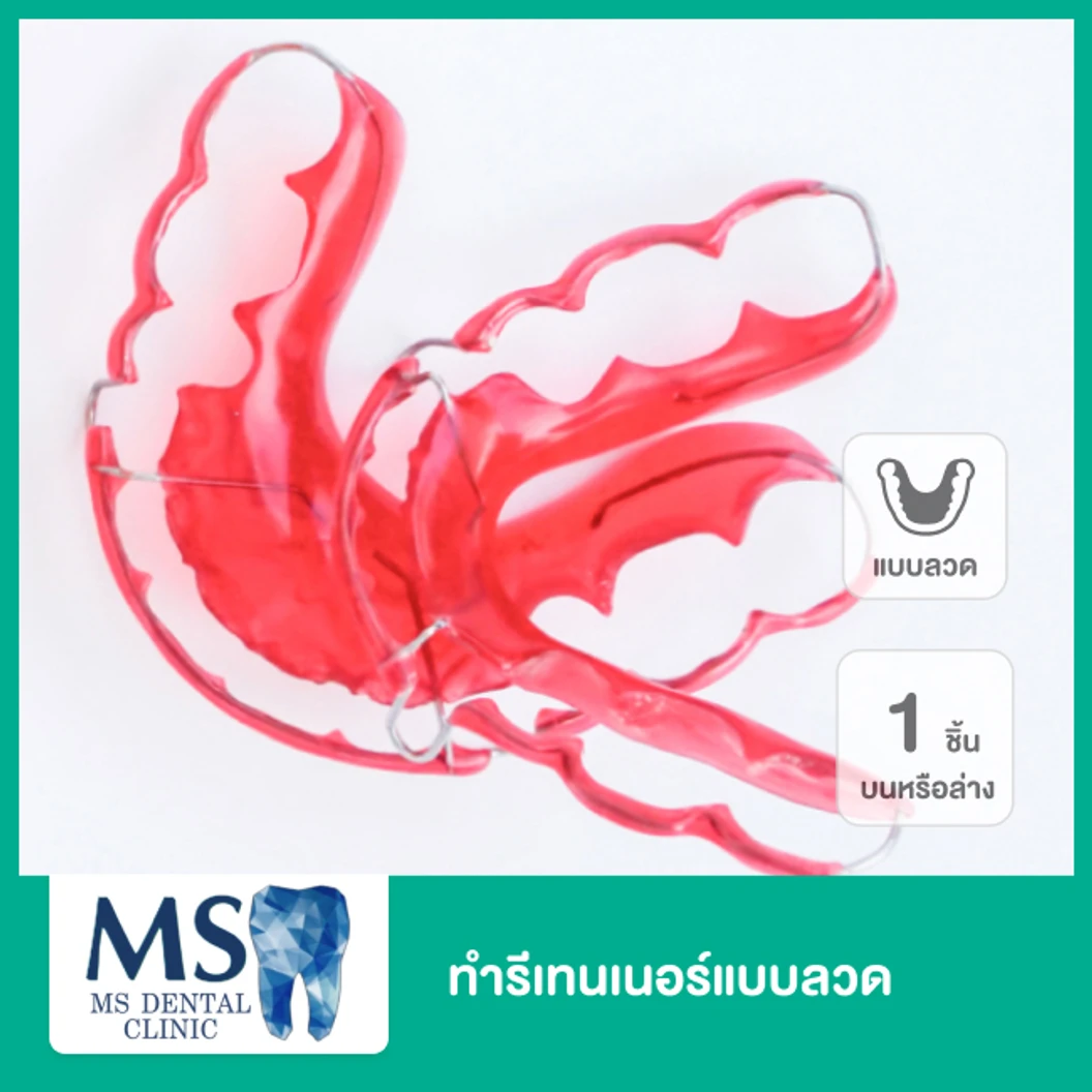 ทำรีเทนเนอร์แบบลวด 1 ชิ้น ฟันบนหรือล่าง