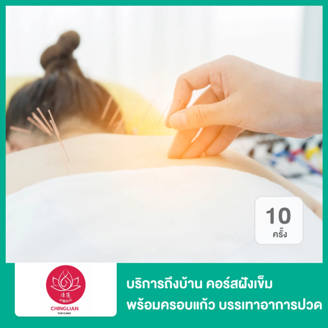 บริการถึงบ้าน คอร์สฝังเข็มพร้อมครอบแก้ว บรรเทาอาการปวด 10 ครั้ง