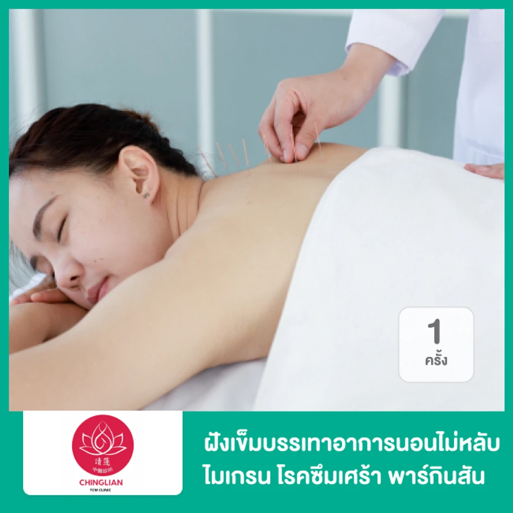ฝังเข็มบรรเทาอาการนอนไม่หลับ ไมเกรน โรคซึมเศร้า พาร์กินสัน 1 ครั้ง