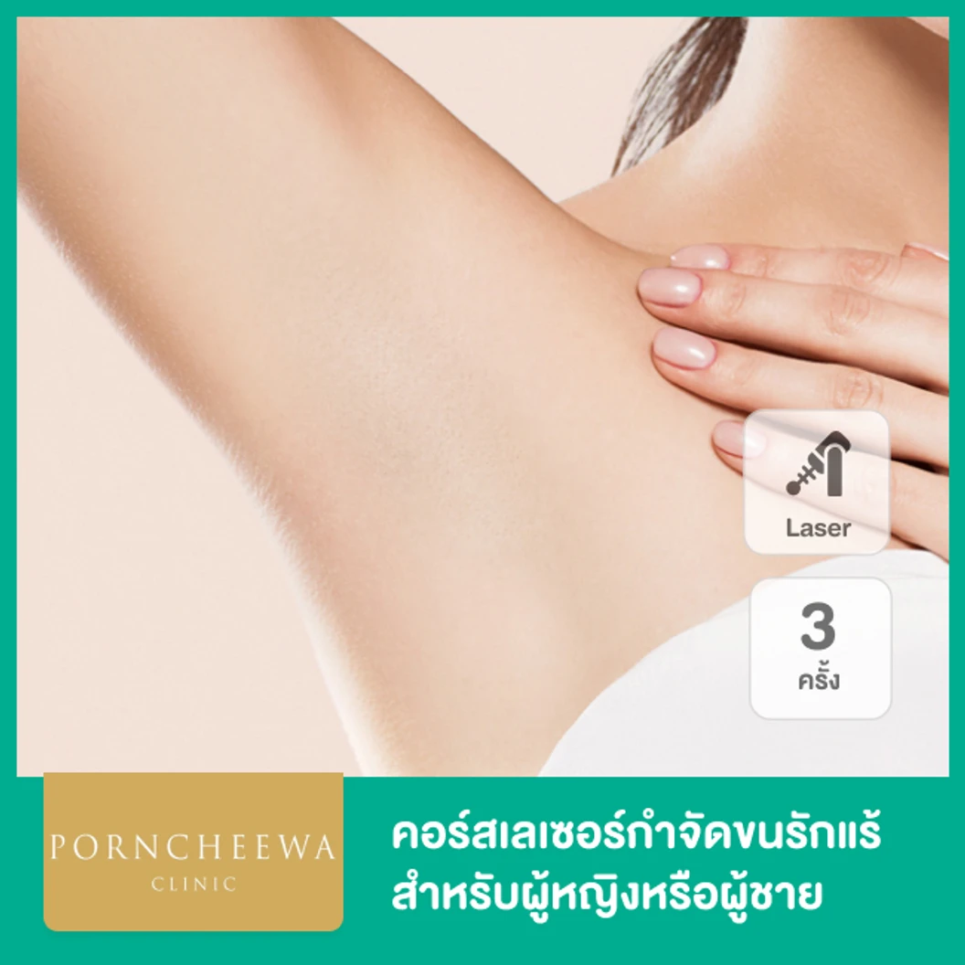 คอร์สเลเซอร์ Premium Ice Diode กำจัดขนรักแร้ 3 ครั้ง