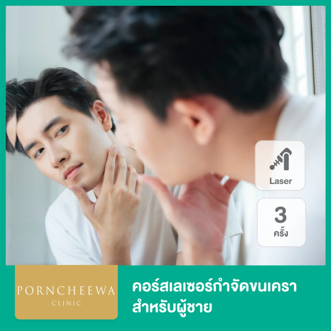 คอร์ส Premium Ice Diode เลเซอร์กำจัดขนเครา 3 ครั้ง สำหรับผู้ชาย