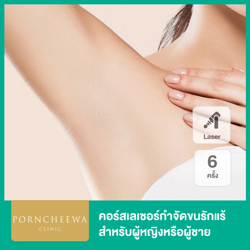 คอร์สเลเซอร์ Premium Ice Diode กำจัดขนรักแร้ 6 ครั้ง