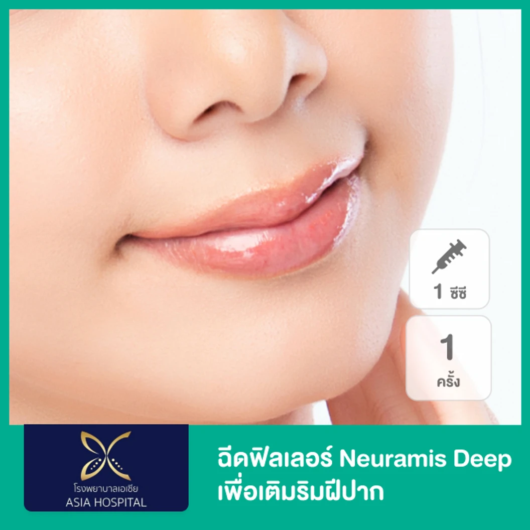 โปรแกรมฟิลเลอร์ 1 ซีซี (ปาก)