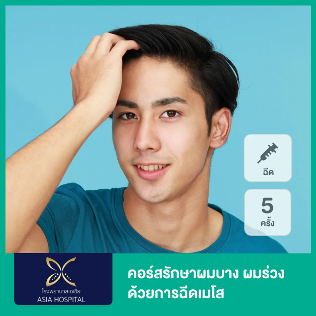 คอร์สรักษาผมบาง ผมร่วง ด้วยการฉีดเมโส 5 ครั้ง