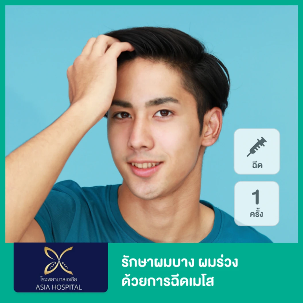 รักษาผมบาง ผมร่วง ด้วยการฉีดเมโส 1 ครั้ง
