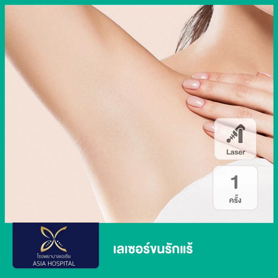 โปรแกรม SHR กำจัดขนรักแร้ 1 ครั้ง