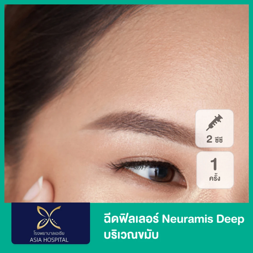 โปรแกรมฟิลเลอร์ 2 ซีซี (ขมับ)