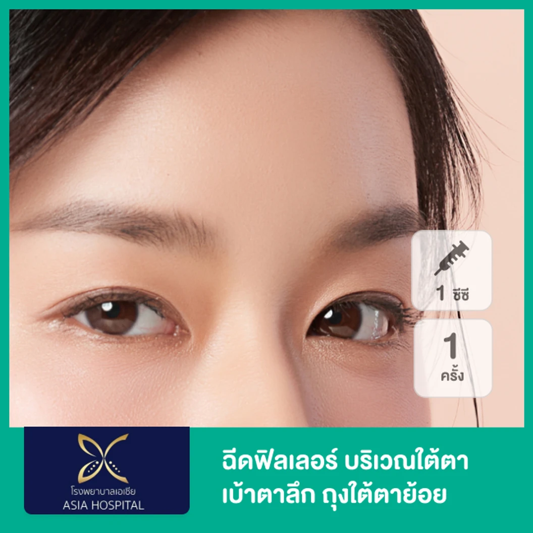 โปรแกรมฟิลเลอร์ 1 ซีซี (ใต้ตา)