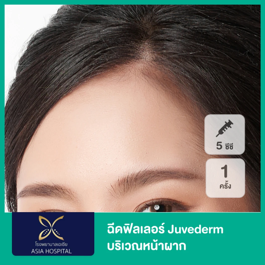 โปรแกรมฟิลเลอร์ 5 ซีซี (หน้าผาก)