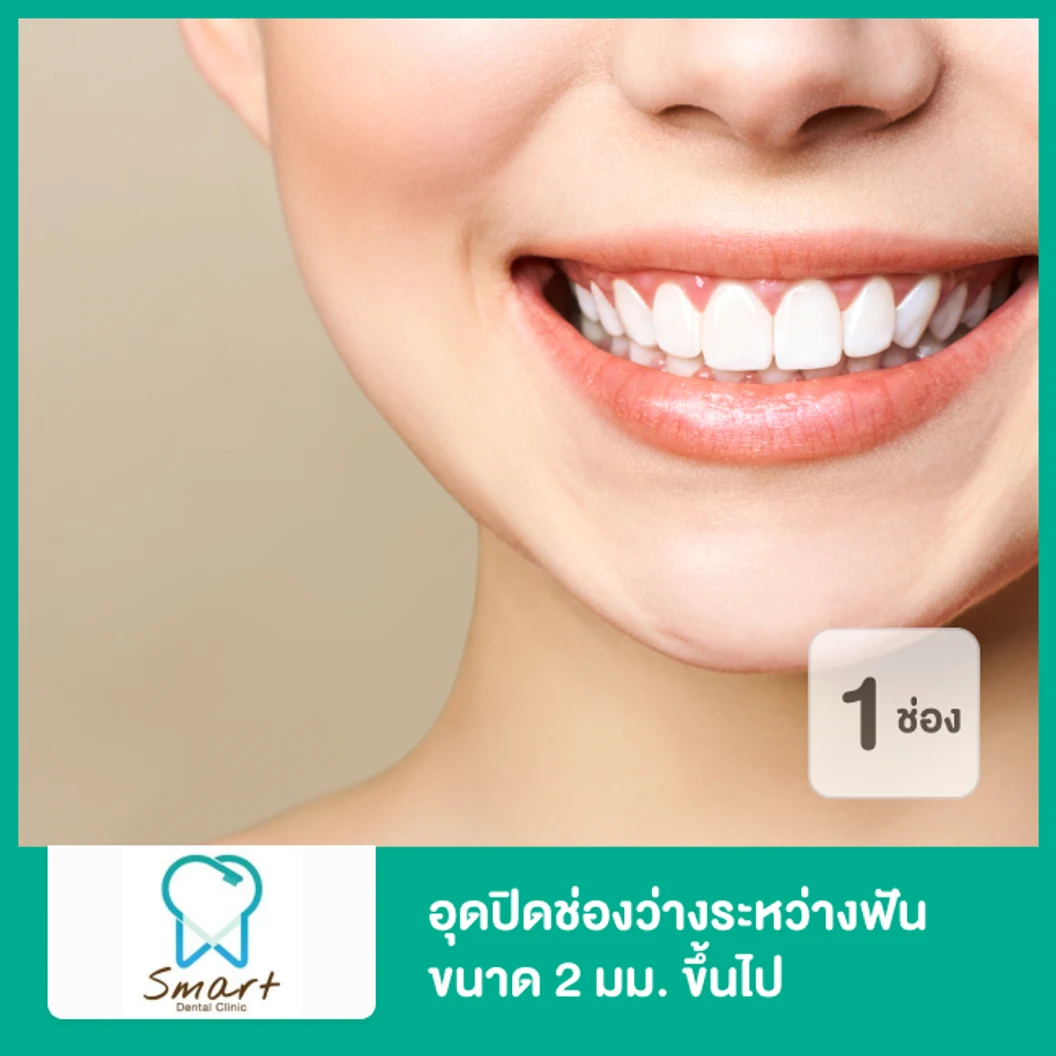 อุดปิดช่องว่างระหว่างฟัน ขนาด 2 มม. ขึ้นไป 1 ช่อง