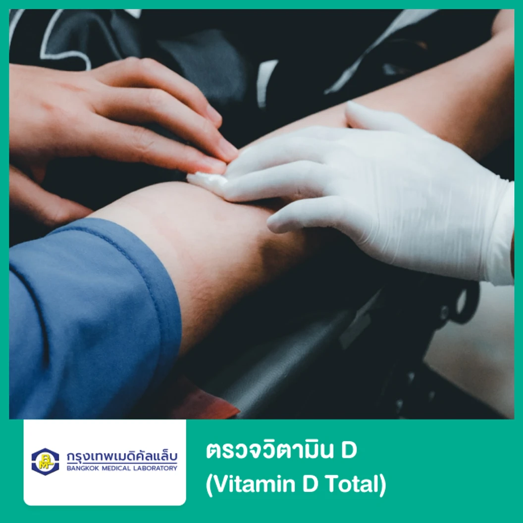 ตรวจระดับวิตามิน D (Vitamin D Total) และ วิตามิน B12