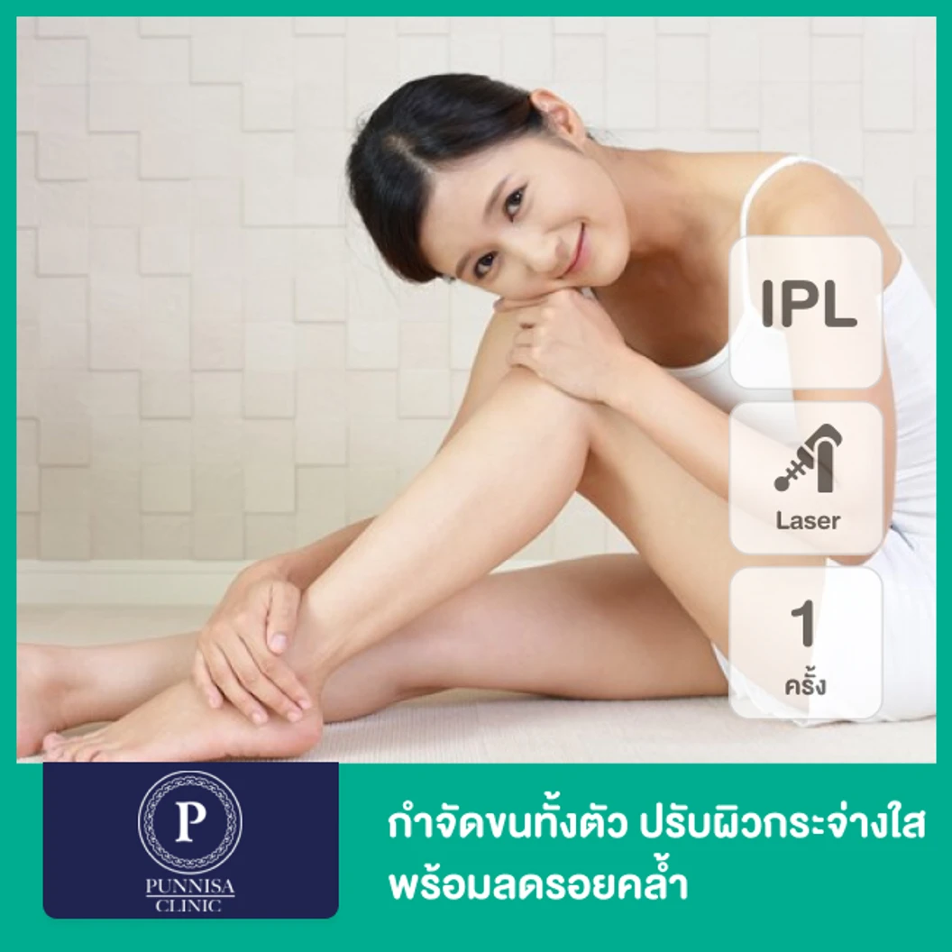 เลเซอร์ Q-Switch Nd:YAG/ IPL กำจัดขนทั่วตัว + ลดรอยคล้ำ 1 ครั้ง