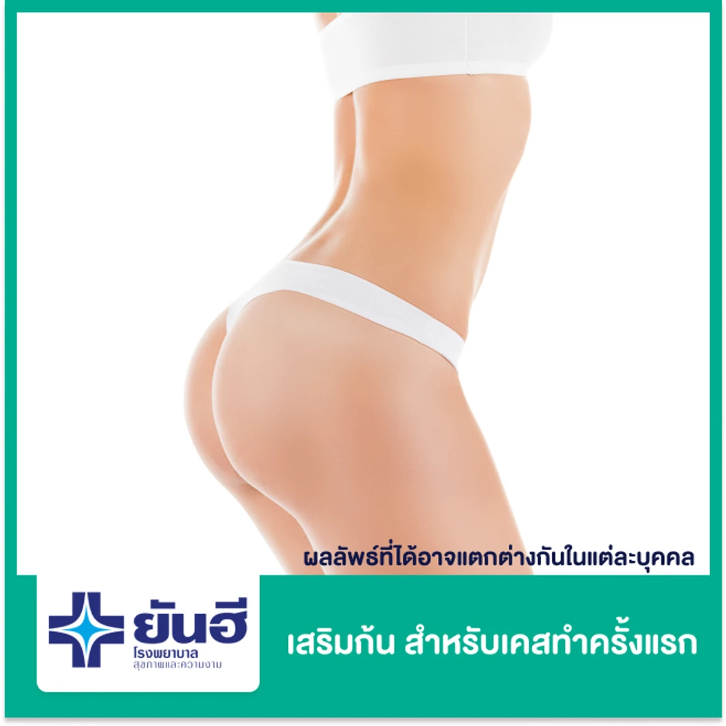 เสริมก้น ด้วยซิลิโคน Motiva สำหรับเคสทำครั้งแรก