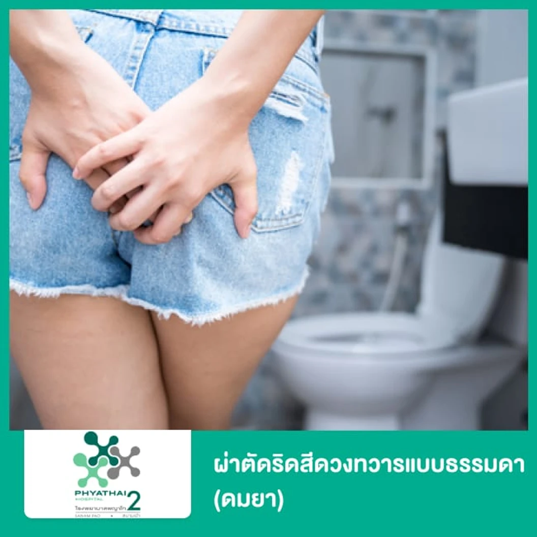 ผ่าตัดริดสีดวงทวารแบบธรรมดา (ดมยา)