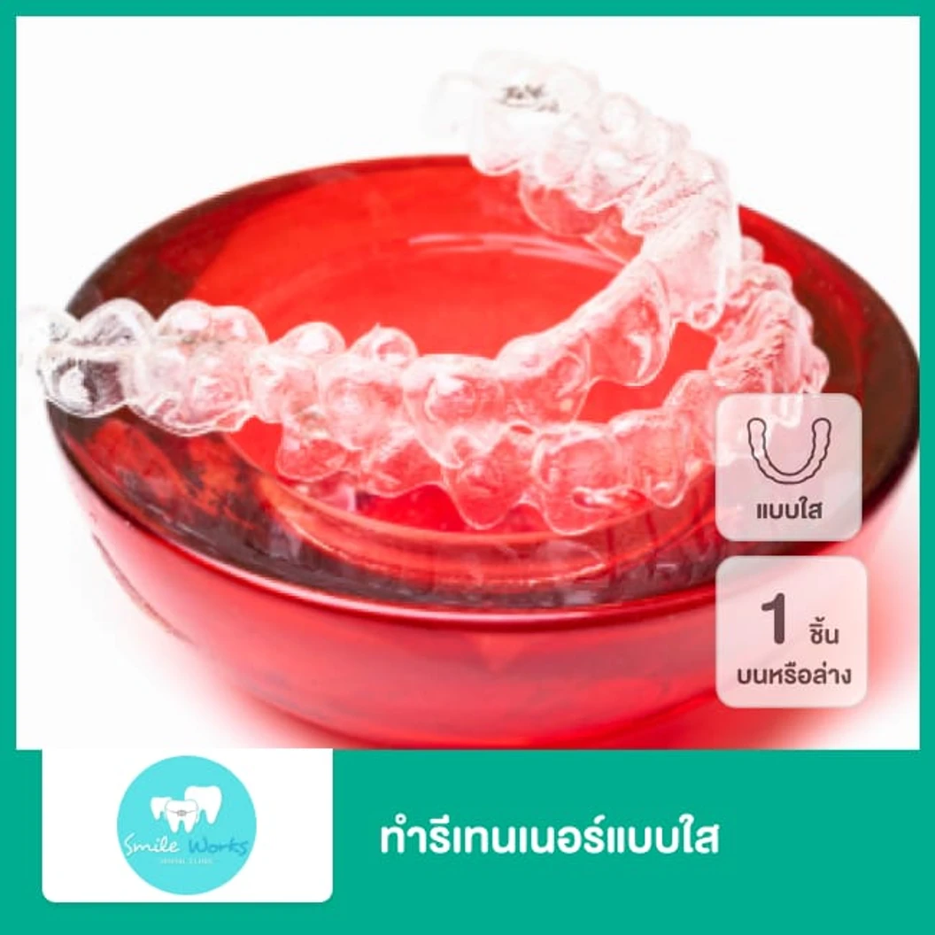 ทำรีเทนเนอร์แบบใส 1 ชิ้น ฟันบนหรือล่าง