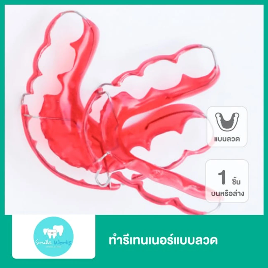 ทำรีเทนเนอร์แบบลวด 1 ชิ้น ฟันบนหรือล่าง