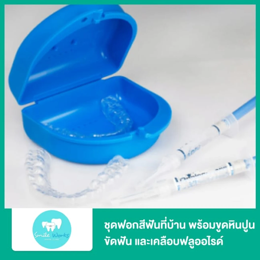 ชุดฟอกสีฟันที่บ้าน ทำถาดฟอกสีฟันเฉพาะบุคคลพร้อมรับน้ำยากลับบ้าน พร้อมขูดหินปูน ขัดฟัน และเคลือบฟลูออไรด์