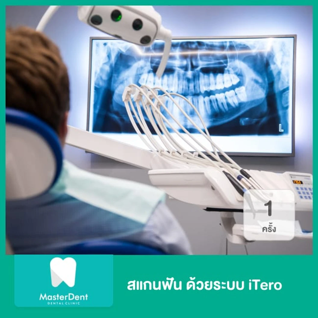 สแกนฟัน ด้วยระบบ iTero 1 ครั้ง