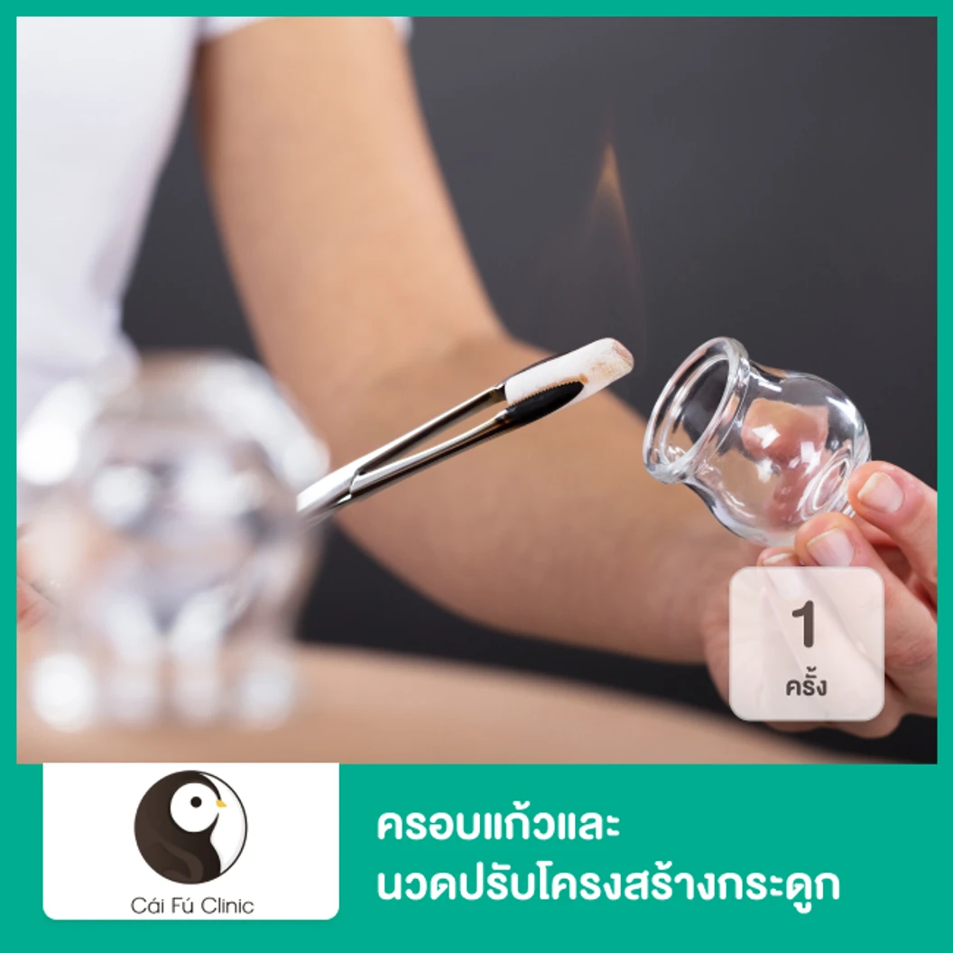 ครอบแก้วและนวดปรับโครงสร้างกระดูก 1 ครั้ง