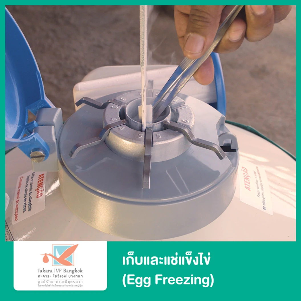 เก็บและแช่แข็งไข่ (Egg Freezing)