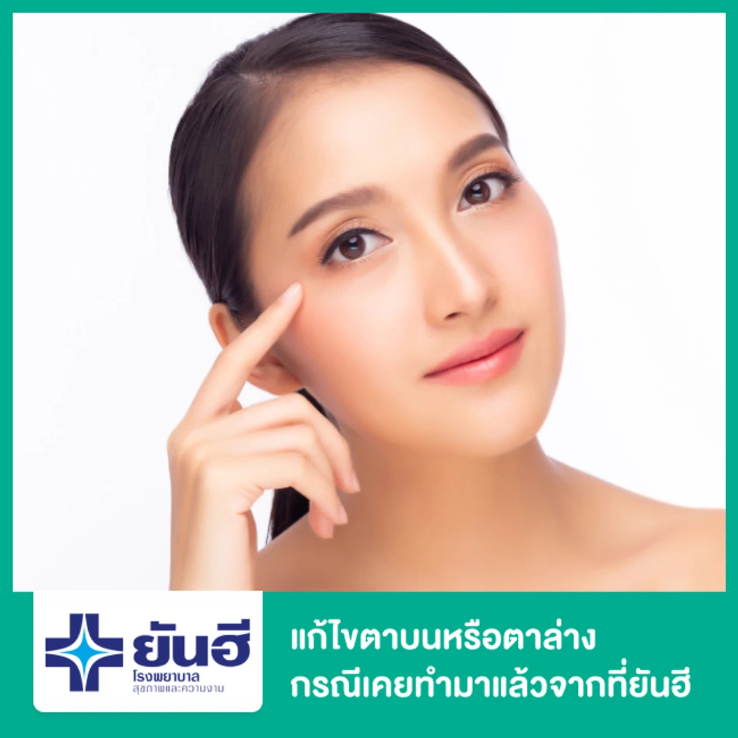 แก้ไขตาบนหรือตาล่าง กรณีเคยทำมาแล้วจากที่ยันฮี