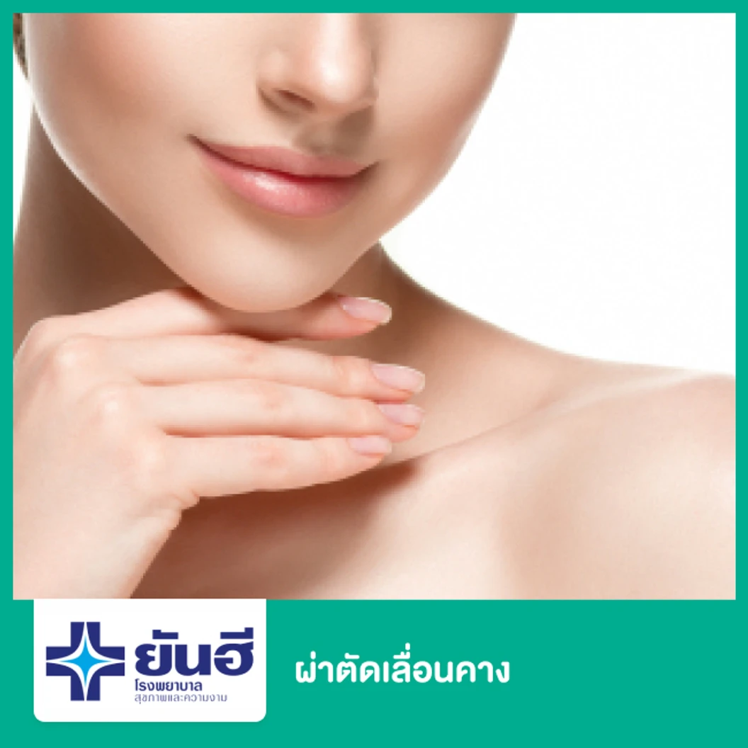 ผ่าตัดเลื่อนคาง เคสทำครั้งแรก