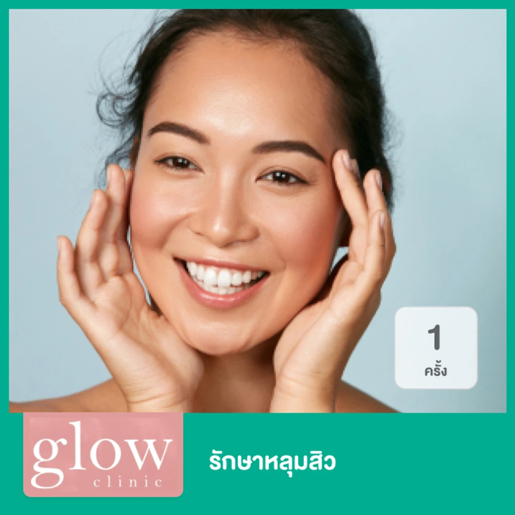 รักษาหลุมสิว ด้วยเทคนิค Subcision 1 ครั้ง