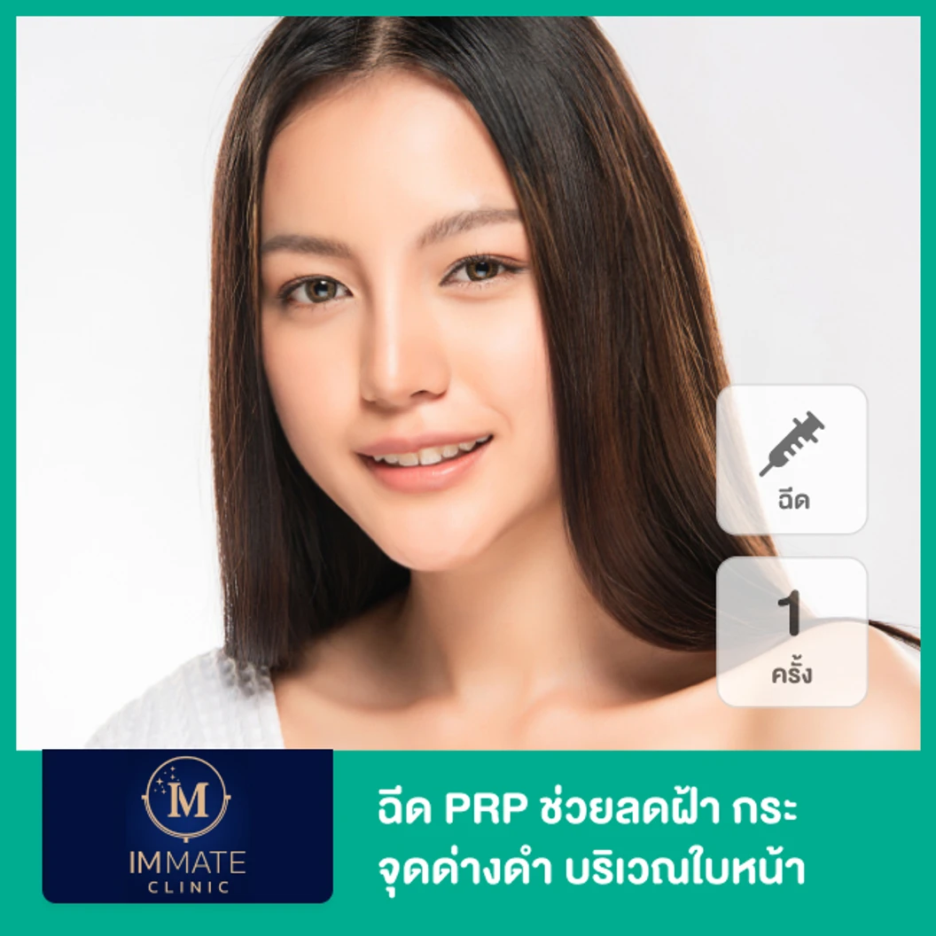 Growth Factor ฉีด PRP ช่วยลดฝ้า กระ จุดด่างดำ บริเวณใบหน้า 1 ครั้ง ที่ Immate Clinic