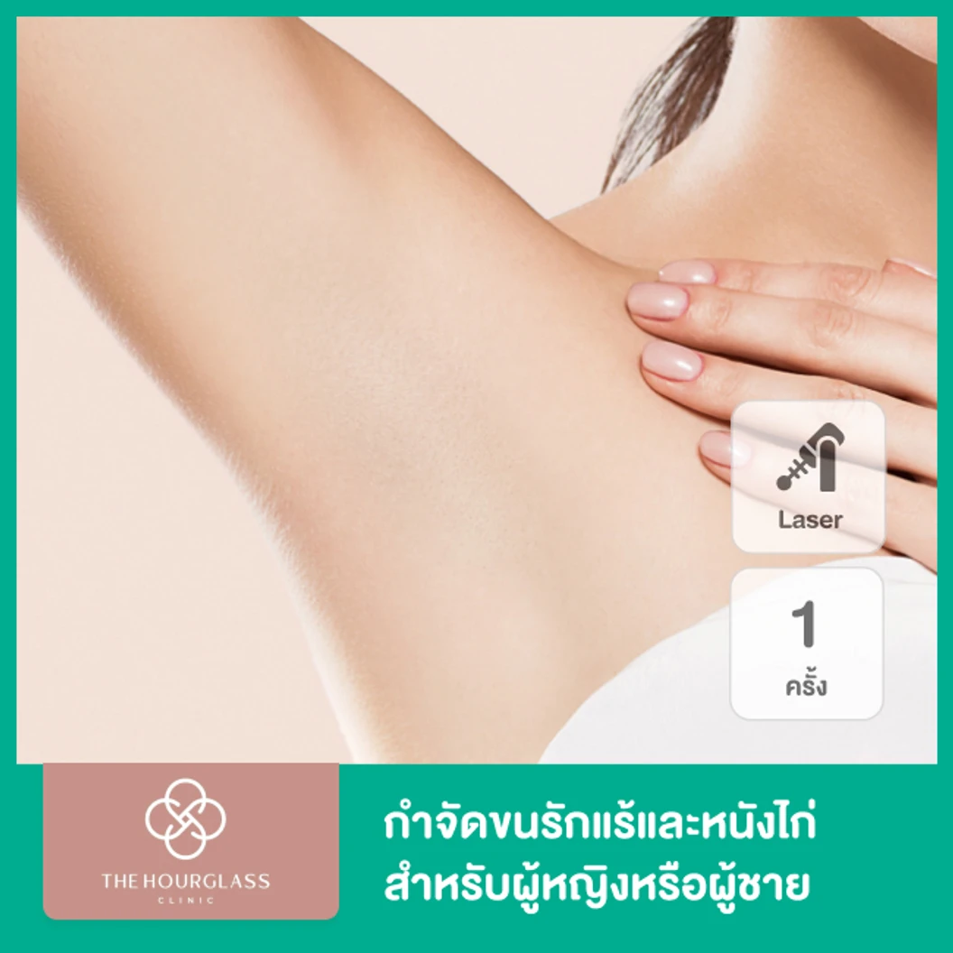 เลเซอร์ Double White กำจัดขนรักแร้ 1 ครั้ง