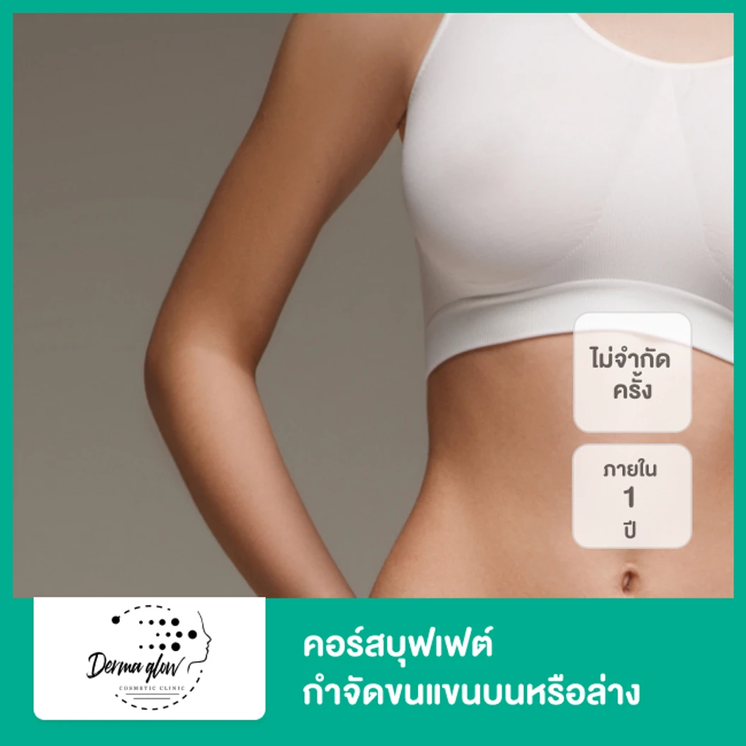 คอร์สบุฟเฟต์กำจัดขนแขนบนหรือล่าง ด้วยเลเซอร์ YAG ไม่จำกัดครั้ง ภายใน 1 ปี