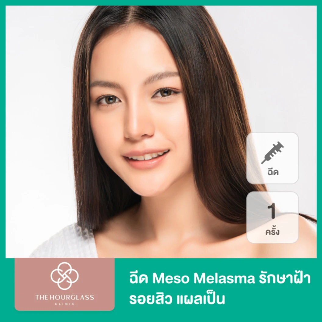 โปรแกรม Meso Melasma รักษาฝ้า รอยสิว แผลเป็น 1 ครั้ง