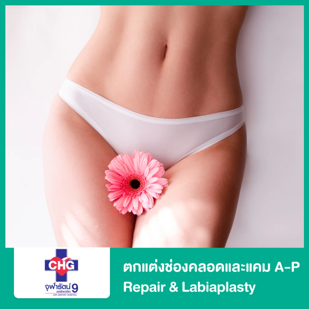 ตกแต่งช่องคลอดและแคม A-P Repair & Labiaplasty ที่ โรงพยาบาลจุฬารัตน์ 9 แอร์พอร์ต