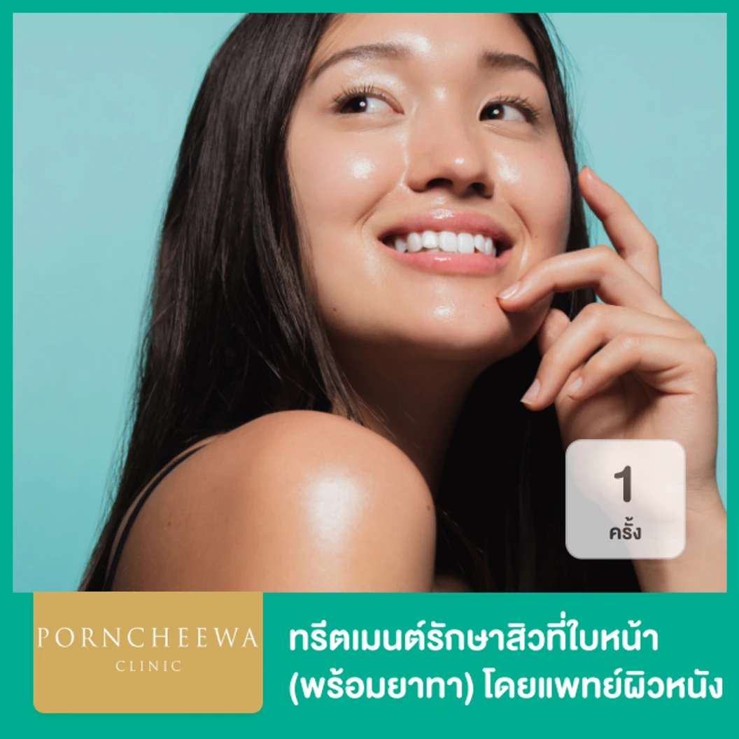 ทรีตเมนต์รักษาสิวที่ใบหน้า (พร้อมยาทา) โดยแพทย์ผิวหนัง 1 ครั้ง
