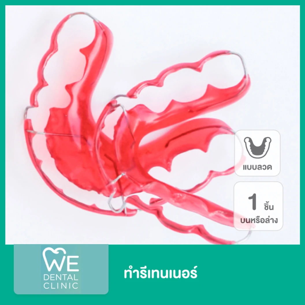 ทำรีเทนเนอร์ แบบลวด 1 ชิ้น ฟันบนหรือล่าง