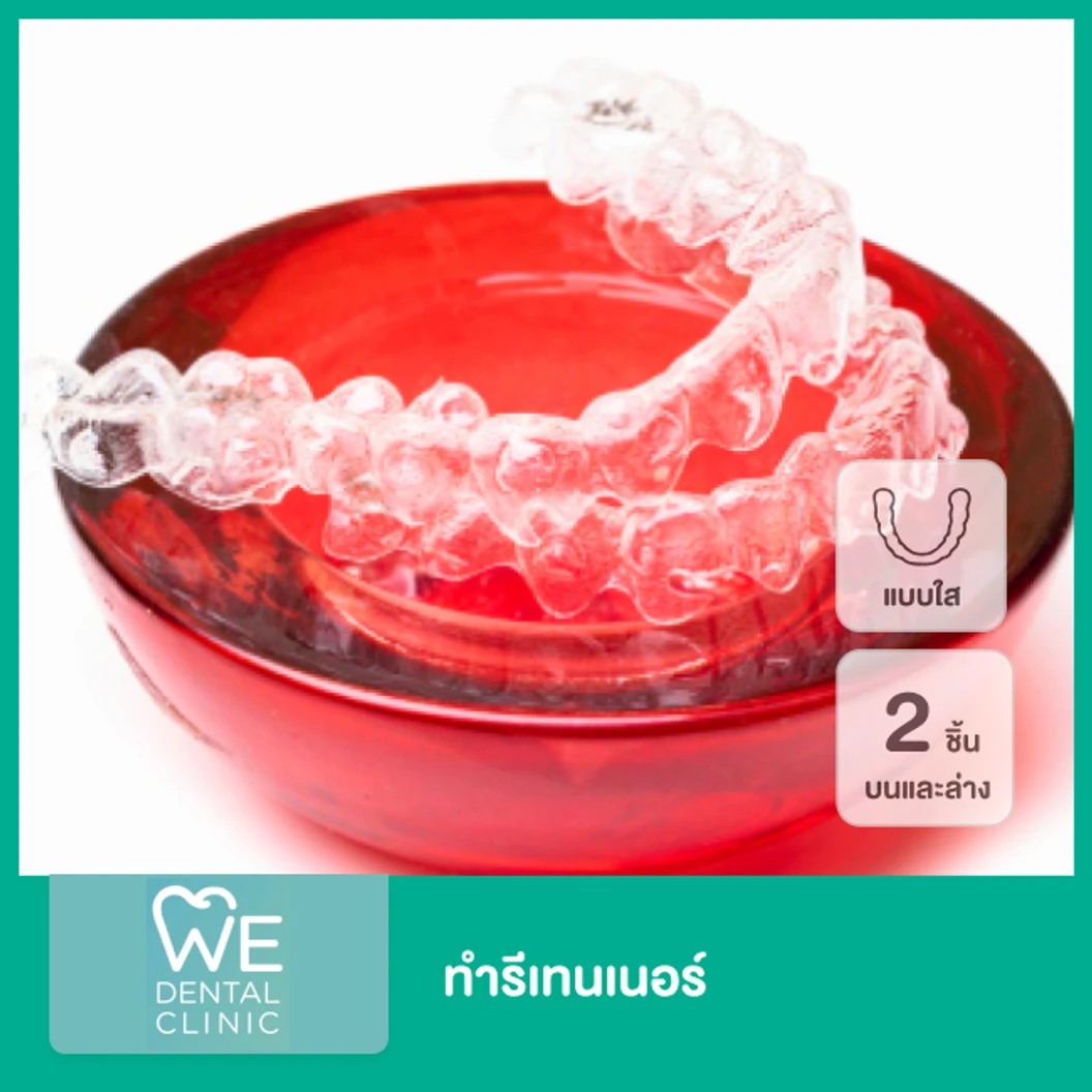 ทำรีเทนเนอร์ แบบใส 2 ชิ้น ฟันบนและล่าง