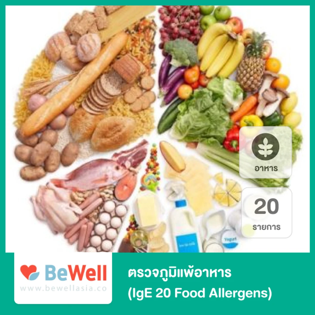 ตรวจภูมิแพ้อาหาร 20 รายการ (IgE 20 Food Allergens)