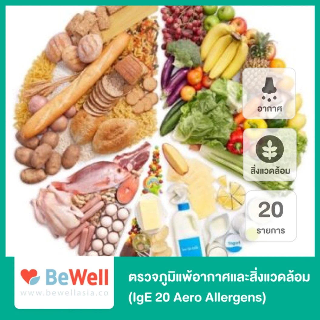ตรวจภูมิแพ้อากาศและสิ่งแวดล้อม 20 รายการ (IgE 20 Aero Allergens)