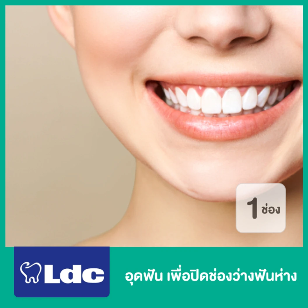 อุดฟัน เพื่อปิดช่องว่างฟันห่าง 1 ช่อง