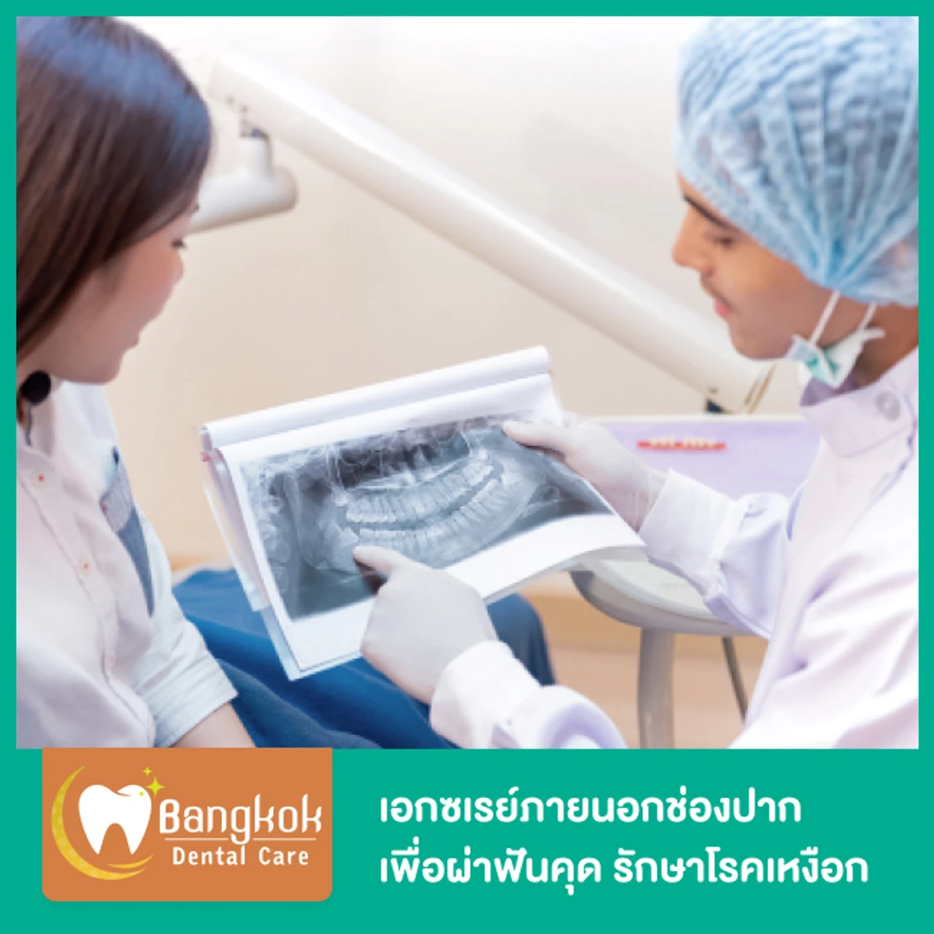 เอกซเรย์ภายนอกช่องปาก Panoramic ฟิล์มใหญ่ เพื่อผ่าฟันคุด รักษาโรคเหงือก หรือจัดฟัน