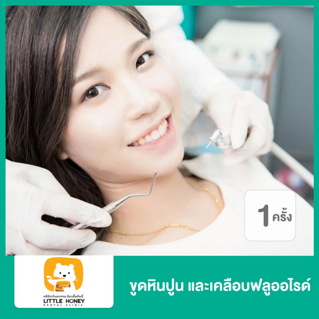 ขูดหินปูน ด้วยเครื่อง Ultrasonic P5 และเคลือบฟลูออไรด์ 1 ครั้ง