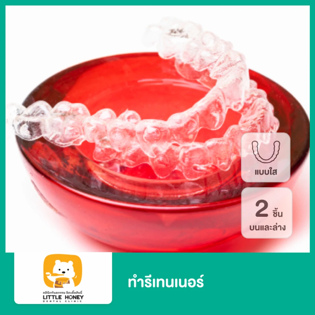 ทำรีเทนเนอร์แบบใส 2 ชิ้น ฟันบนและล่าง