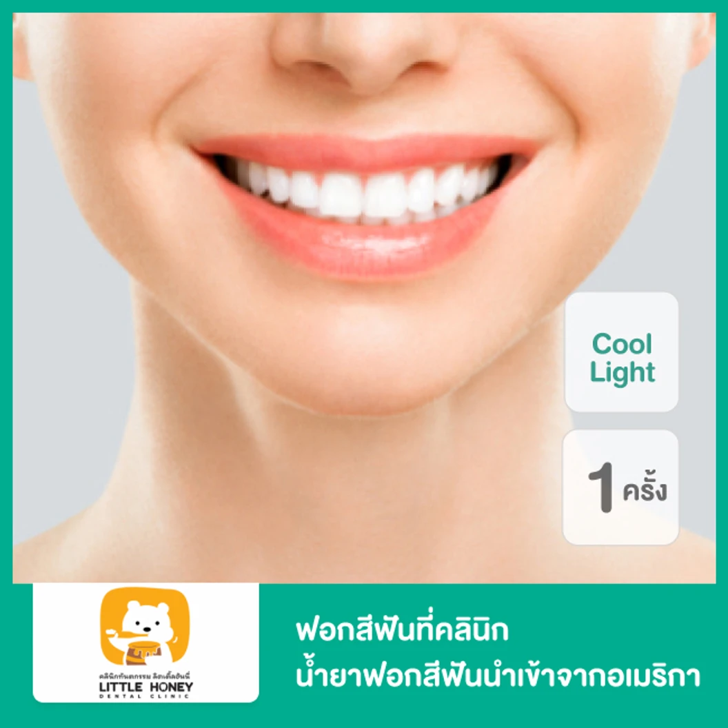 ฟอกสีฟันที่คลินิก ด้วยระบบ Cool Light น้ำยาฟอกสีฟันนำเข้าจากอเมริกา 1 ครั้ง