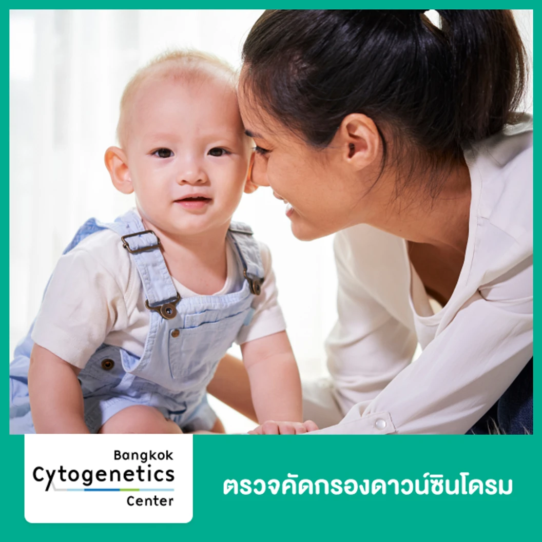 ตรวจคัดกรองดาวน์ซินโดรม Panorama Basic Plus 22q11.2 Deletion