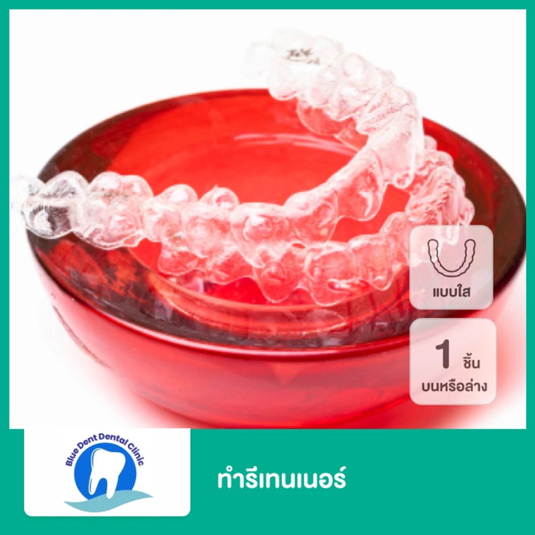 ทำรีเทนเนอร์แบบใส 1 ชิ้น ฟันบนหรือล่าง